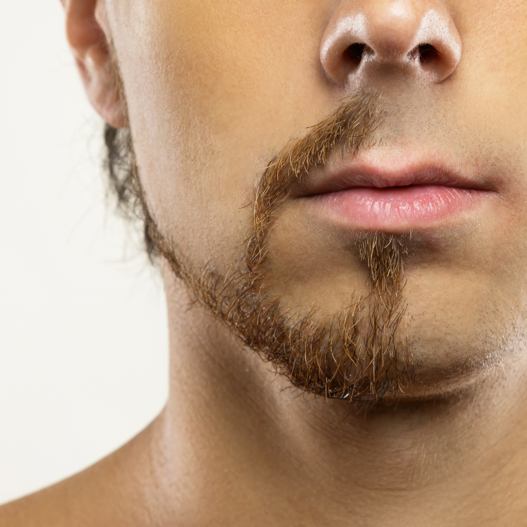 Top 5 Elements for Healthy Beards
